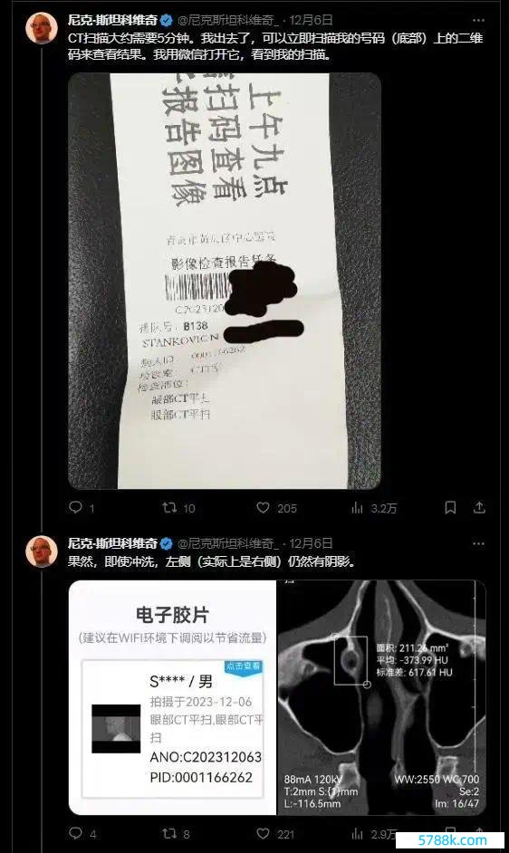 老外共享在中国看病的资格 激发了多半的盘问